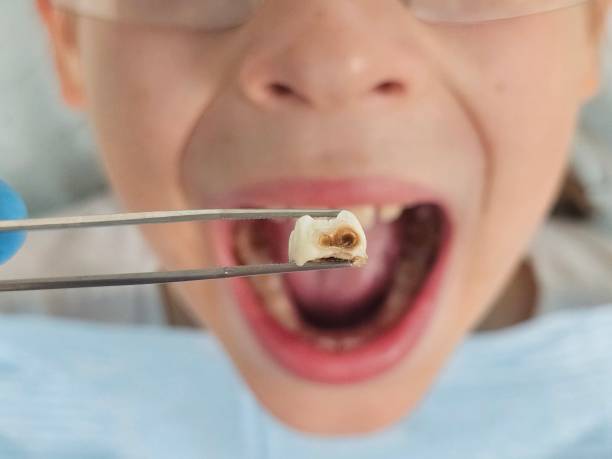 Best Tooth Infection Emergency Dentist  in Thief River Falls, MN